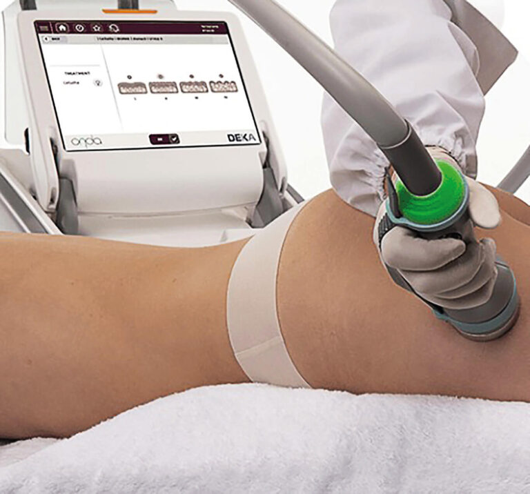 Lo último para tratar la celulitis